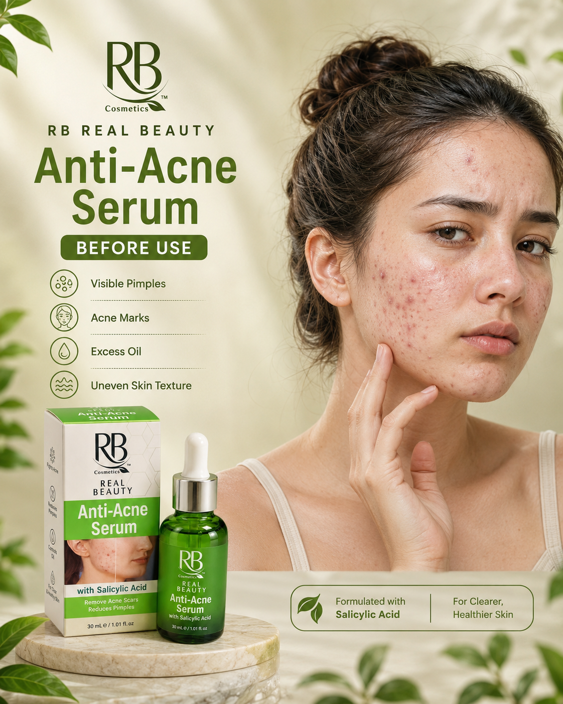 RB Anti-Acne Serum 30ml